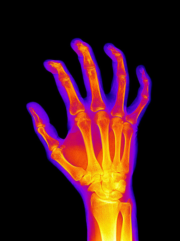 手,骨骼,关节,无人,竖图,插画,室内,白天,正面,数码,科技,阴影,黑色背景,网络,骨头,高光,几何,计算机图形,合成,图画,画,一只,红色,手部,电脑合成图,数码合成图,骨架,漫画,写实,具体,具象,指骨,彩图