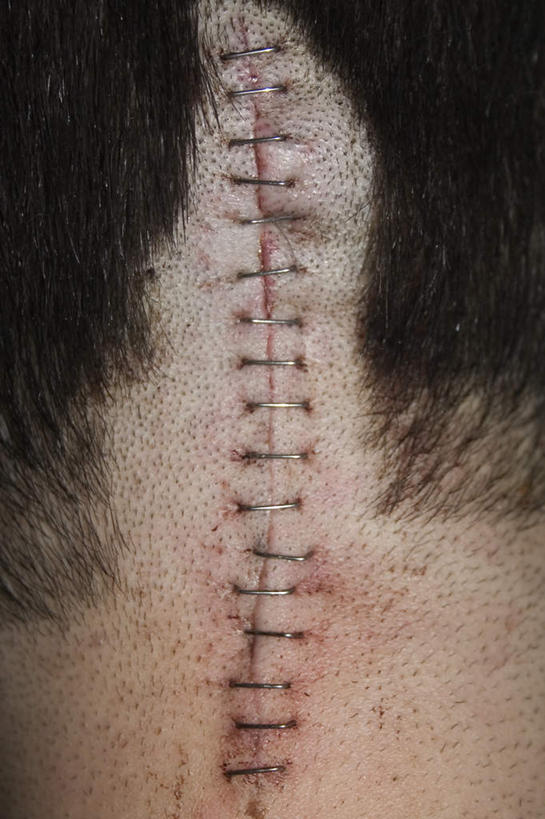 西方人,头发,一个人,医院,竖图,室内,特写,白天,欧洲,欧洲人,仅一个男性,仅一个人,一排,阴影,整齐,反射,影子,排列,仅一个年轻男性,背面,队列,医疗机构,疤痕,男人,男性,年轻男性,白种人,半身,彩图,病院,诊所