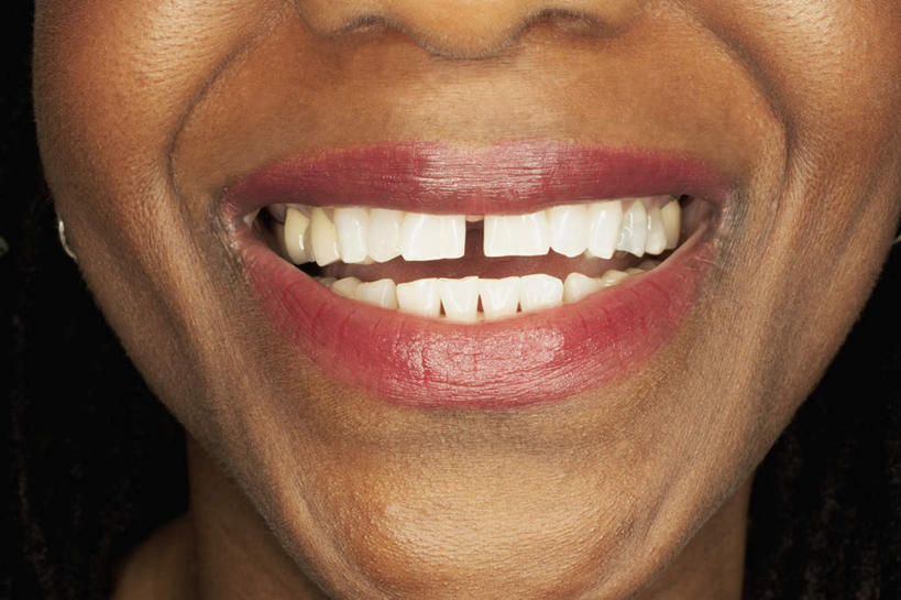 西方人,鼻子,嘴,牙齿,一个人,笑,微笑,露齿笑,横图,室内,特写,白天,正面,欧洲,非洲,黑人,欧洲人,仅一个女性,仅一个人,黑色背景,仅一个中年女性,摄影,影棚,女人,女性,中年女性,非洲人,鼻,鼻孔,齿,口,口腔,牙,牙龈,嘴巴,嘴唇,半身,彩图,影棚拍摄,拍摄