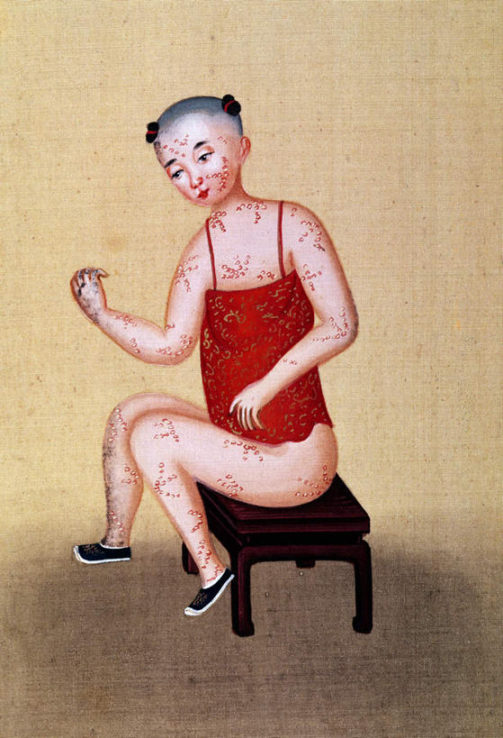 东方人,儿童,一个人,无人,坐,竖图,室内,白天,正面,民族服装,绘画,纯洁,亚洲,仅一个男性,仅一个人,服装,艺术,古典,注视,黄种人,文化,传统,小孩,衣服,红色,工艺品,观察,看,品味,仅一个小孩,肚兜,可爱,童年,童趣,服饰,观看,古装,美术,察看,疾病,高雅,关注,童真,烂漫,无邪,美学,传染,韵味,传染病,DNA病毒,痘病毒,天花,烈性传染病,天真,男孩,男人,男性,亚洲人,孩子,坐着,彩图,全身,传统服装,民俗服,天花病毒,男生