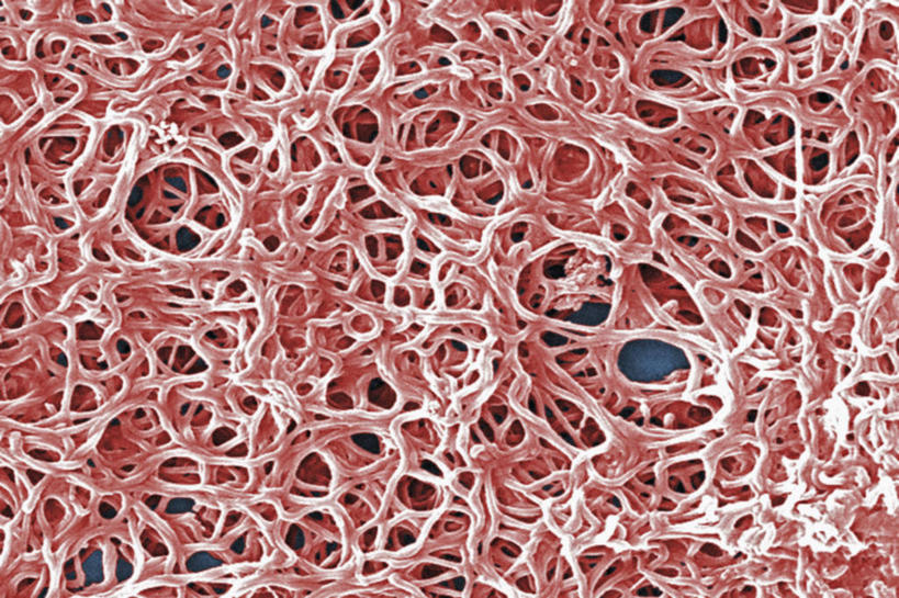 意大利面,无人,横图,仪器,检查,反射,分析,科学,细菌,显微镜,意大利食品,粉色,观察,生病,清晰,探索,摄影,放大,观看,仔细,透镜,有毒物质,凸透镜,聚焦,关注,痛苦,光学,清楚,莱姆病,彩图,扫描电镜,扫描电子显微镜,厌氧菌