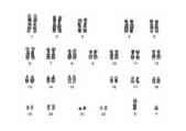 tkf001_113289