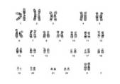 tkf001_113387