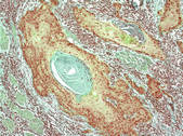tkf001_410031