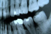 tkf001_647506